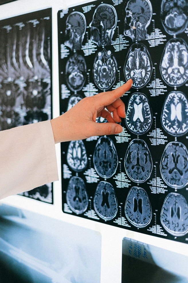 Carnea care face rău creierului! Tu o mănânci? Care e alternativa mai sănătoasă